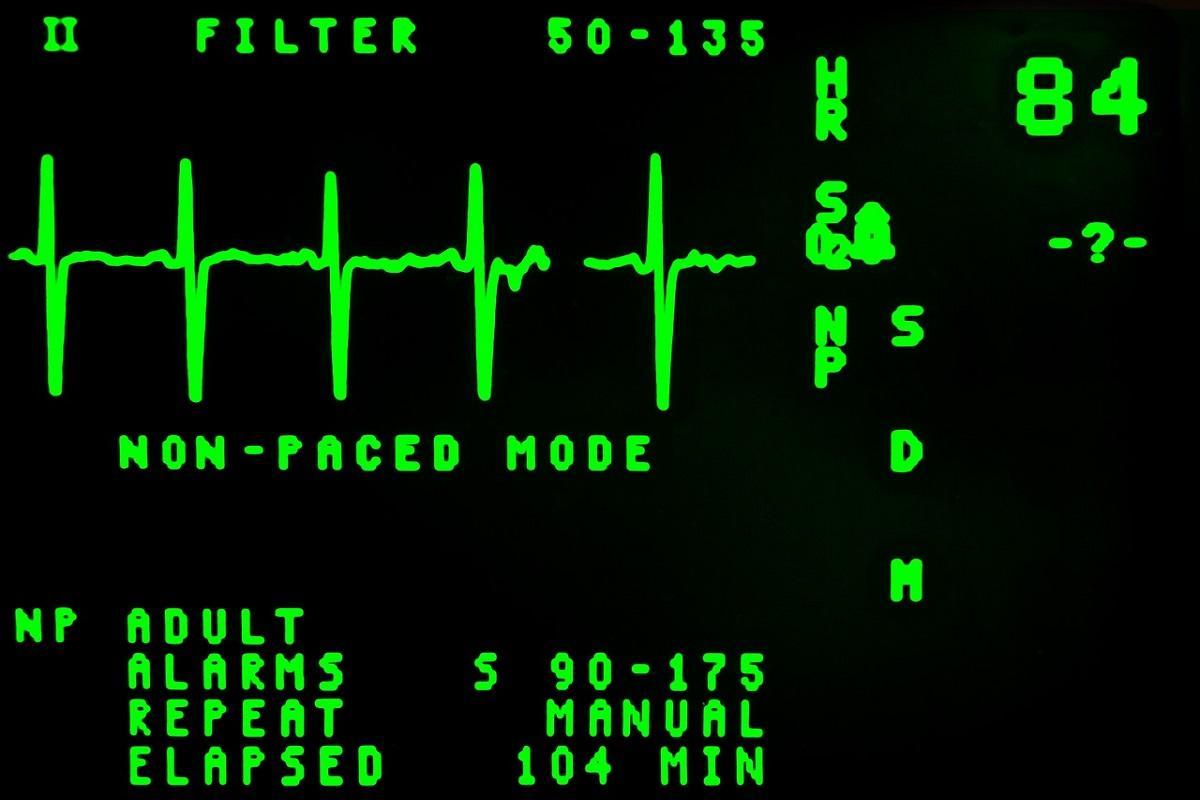 el El electrocardiograma proporciona mucha información a los especialistas en cardiología.